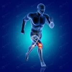 3d male medical figure running with knee bone hig crca208b44b size5.32mb 6000x6000 - title:Home - اورچین فایل - format: - sku: - keywords:وکتور,موکاپ,افکت متنی,پروژه افترافکت p_id:63922
