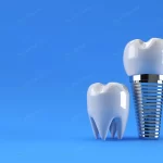 dental implants surgery concept 3d rendering crc9292d936 size1.72mb 4500x3060 - title:Home - اورچین فایل - format: - sku: - keywords:وکتور,موکاپ,افکت متنی,پروژه افترافکت p_id:63922