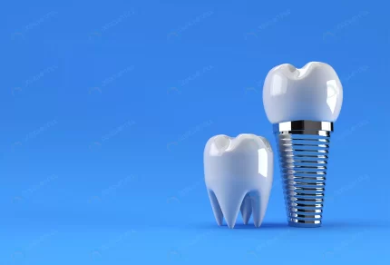 dental implants surgery concept 3d rendering crc9292d936 size1.72mb 4500x3060 - title:graphic home - اورچین فایل - format: - sku: - keywords: p_id:353984
