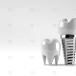 dental implants surgery concept 3d rendering crce13d2507 size1.58mb 4500x3060 - title:Home - اورچین فایل - format: - sku: - keywords:وکتور,موکاپ,افکت متنی,پروژه افترافکت p_id:63922