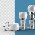 dental implants surgery concept transparent psd f crc66c60a22 size61.91mb - title:Home - اورچین فایل - format: - sku: - keywords:وکتور,موکاپ,افکت متنی,پروژه افترافکت p_id:63922