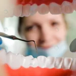 dentistry view from mouth framed by teeth crcce4b27b4 size4.26mb 4256x2537 - title:Home - اورچین فایل - format: - sku: - keywords:وکتور,موکاپ,افکت متنی,پروژه افترافکت p_id:63922