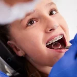 - girl with braces during routine dental examinatio crc38f47426 size16.07mb 7360x4912 - Home