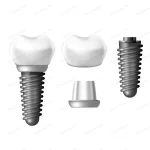 component parts dental implant teeth denture crcaa45ad77 size2.85mb - title:Home - اورچین فایل - format: - sku: - keywords:وکتور,موکاپ,افکت متنی,پروژه افترافکت p_id:63922