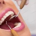 dentist examining female patient teeth crcdce1525d size21.49mb 8688x5792 - title:Home - اورچین فایل - format: - sku: - keywords:وکتور,موکاپ,افکت متنی,پروژه افترافکت p_id:63922